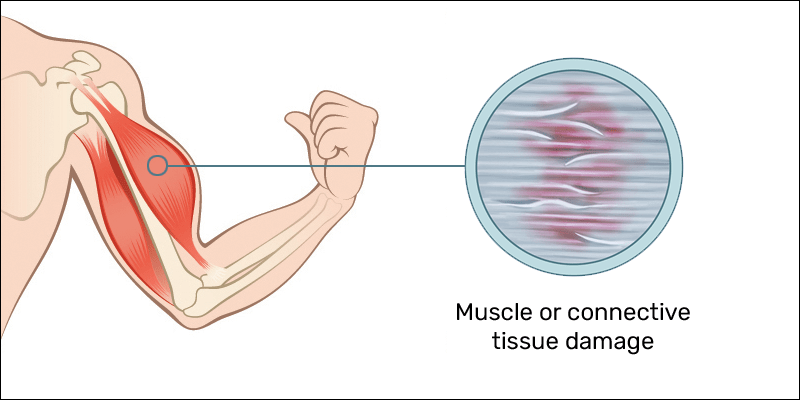 microtears in muscle