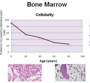 bone marrow density