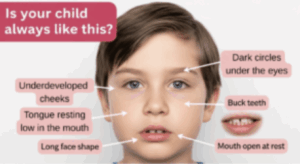 Child tongue posture