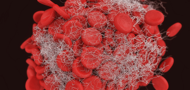 Blame the Bugs How Stealth Pathogens Are Making You Fat, Tired, and Brain Dead