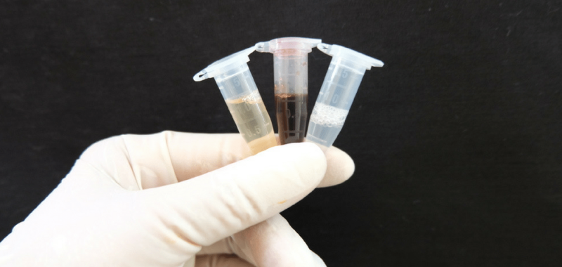 Fun With Blood, Saliva, and Ben Greenfield