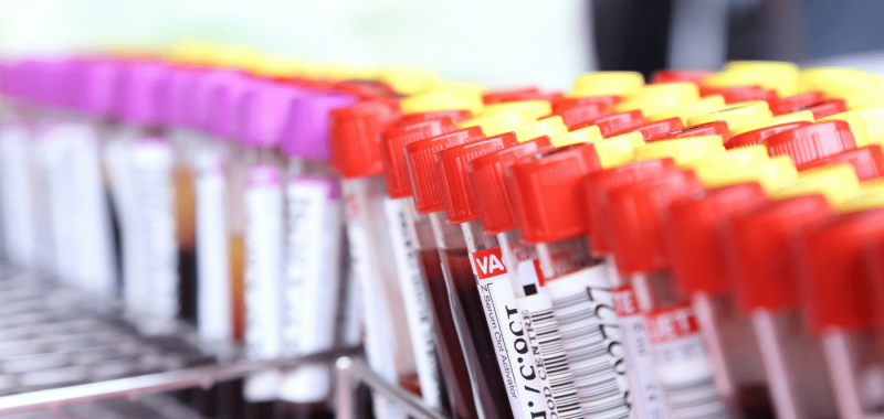 Get Your Blood Tested Without Spending Tons of Money