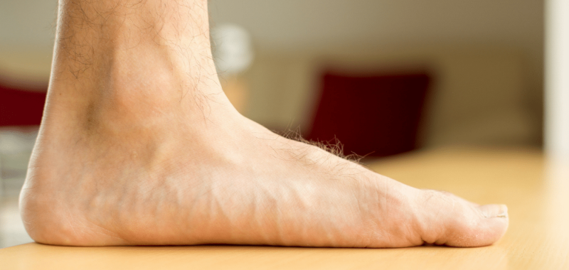 How To Get Rid of Flat Feet