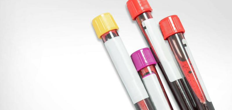 The Blood Test Your Doctor Won't Order