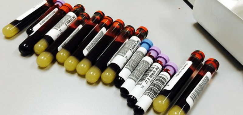 The Most Comprehensive Blood Test