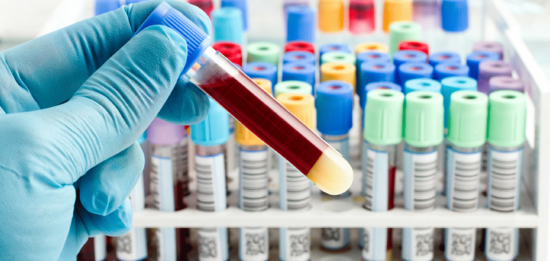 What Happens To Your Body & Blood When You Race Back-To-Back Spartan Races