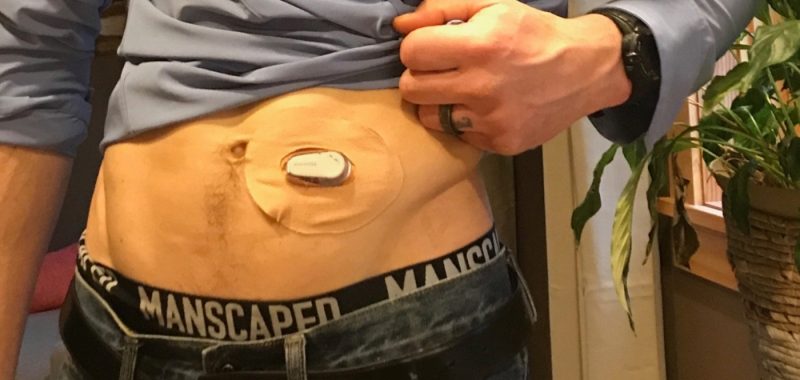 heart rate variability